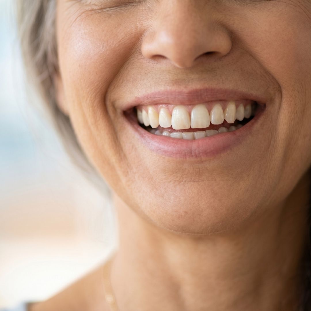Close-up of a woman's bright, healthy smile showing natural-looking teeth